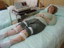 Jill connected to the Electric Wave tHerapy Unit